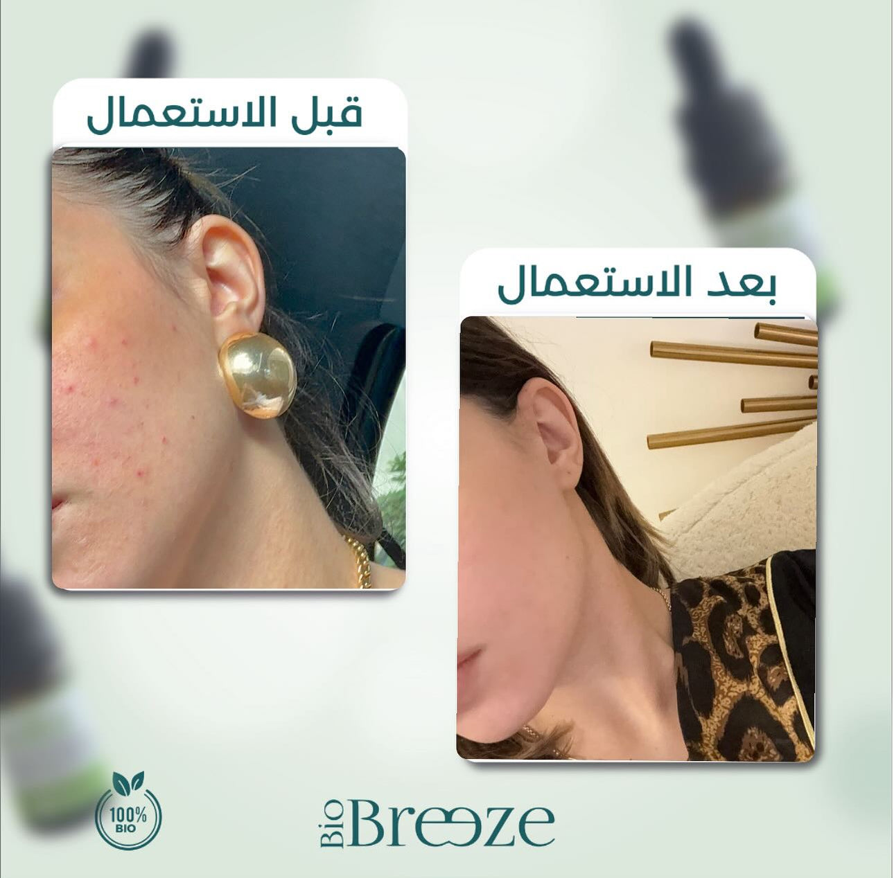 bio breeze