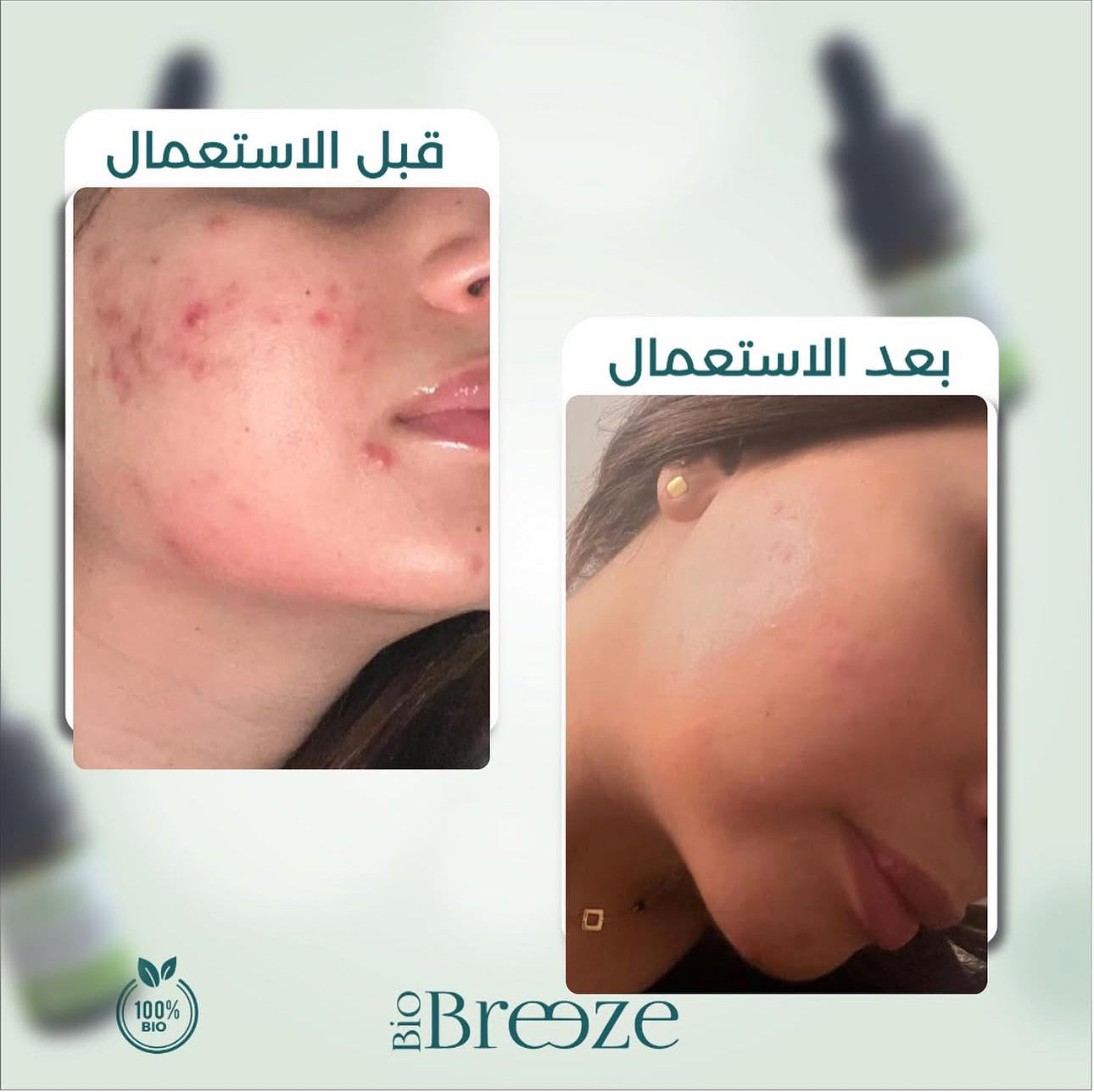 bio breeze