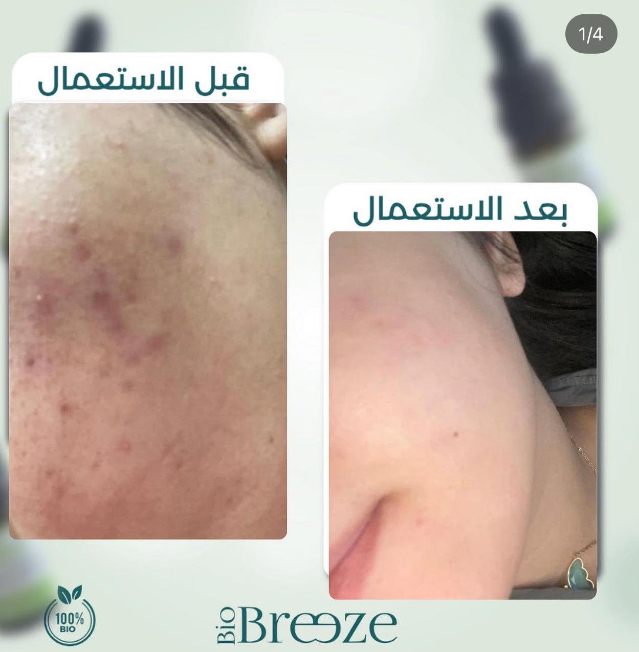 bio breeze